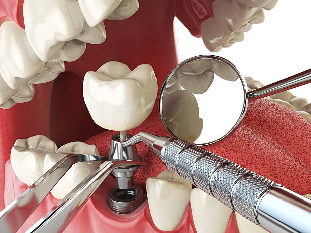 Best Emergency Gum Treatment in Galesville, MD